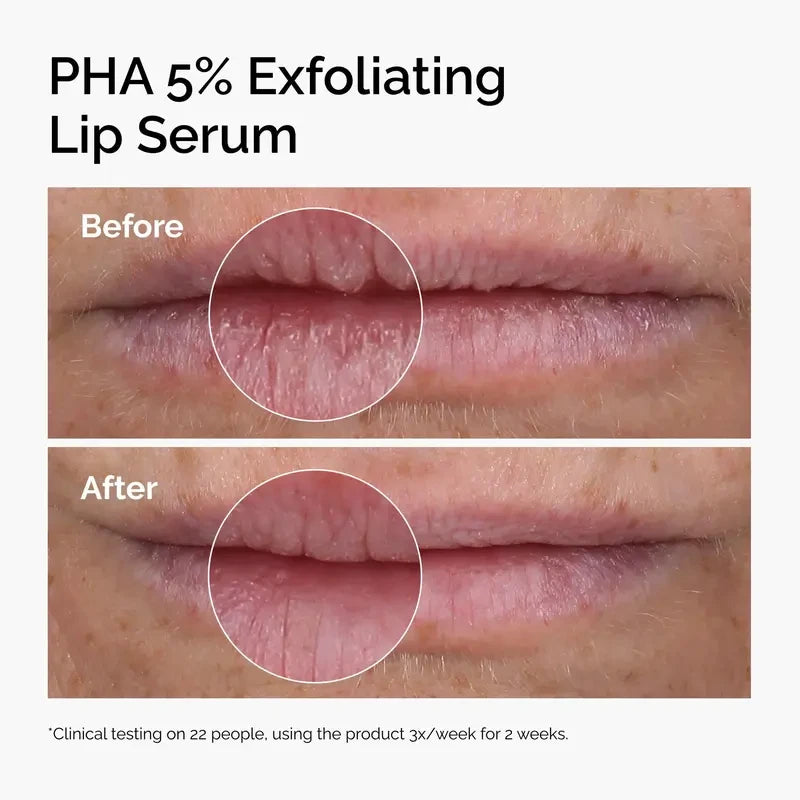 PHA Exfoliating Lip Serum