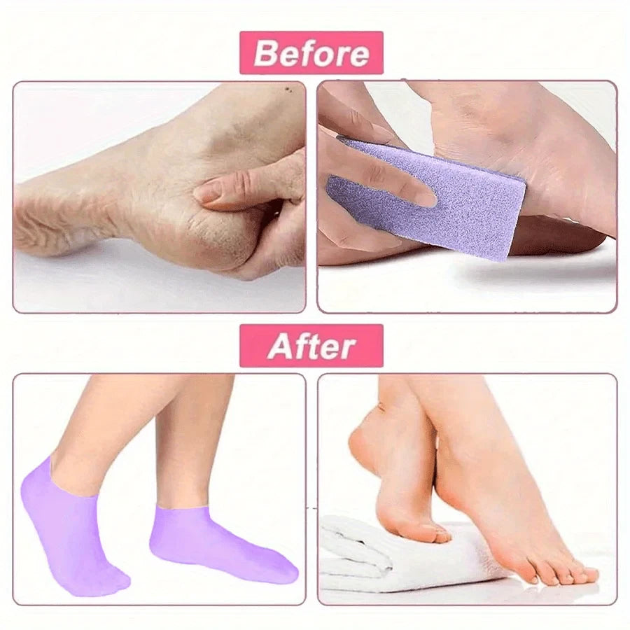 Silicone Moisturizing Heel Socks